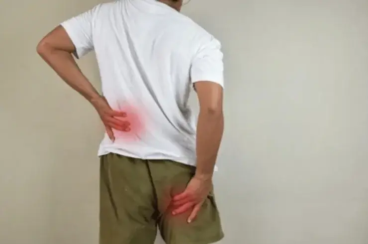 Sciatica Management