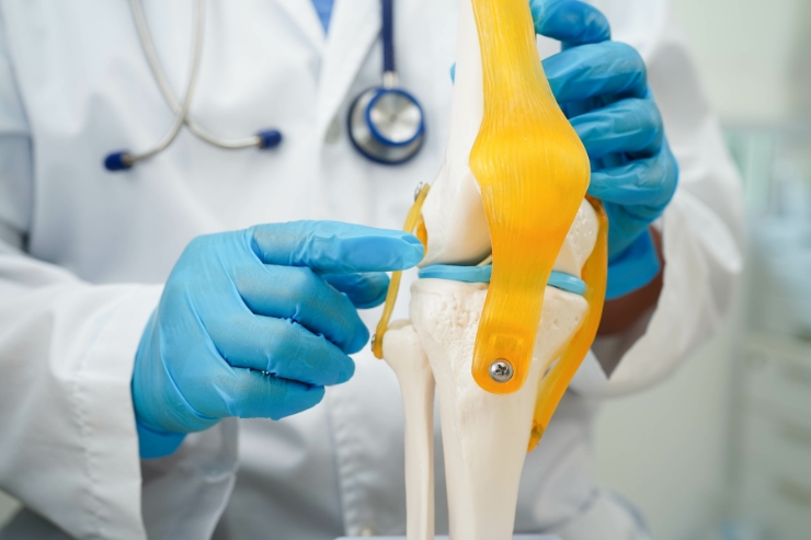 Joint Preservation Procedures